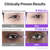Numbuzin No.9 NAD Collagen Under Eye Patch cooling hydrogel patches for brightening and depuffing tired eyes